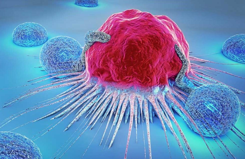 Πιο ευάλωτοι οι άνδρες στον καρκίνο - Αιτία οι βιολογικές διαφορές των δύο φύλων