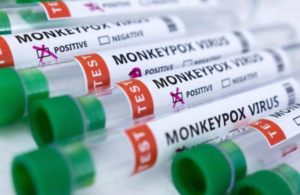 Το Υπουργείο Υγείας εξασφάλισε εμβόλια για την ευλογιά των πιθήκων - Πότε έρχονται οι πρώτες δόσεις