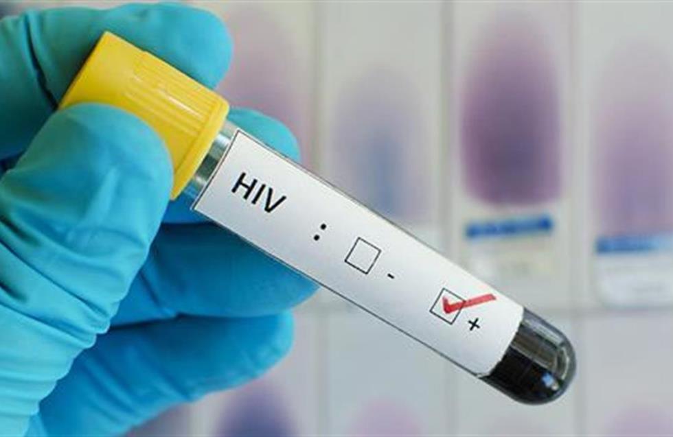 Ρεκόρ μετάδοσης HIV/AIDS: Στα 170 τα νέα περιστατικά για το 2022